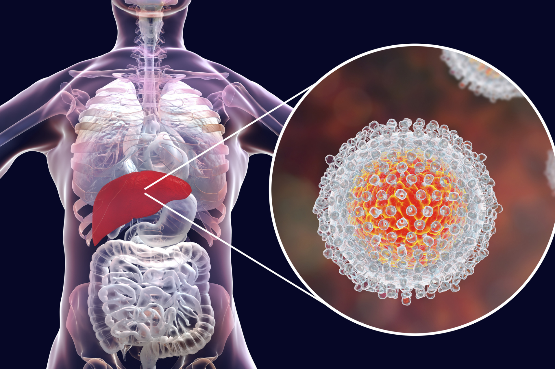 Hepatitis C Virus